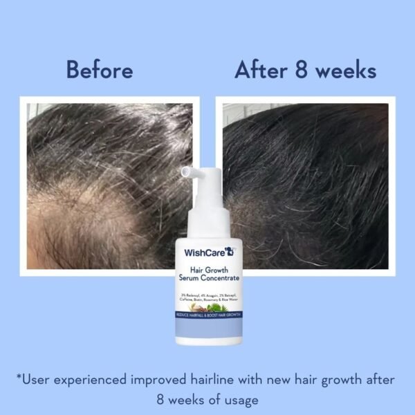 Wishcare Hair Growth Serum Concentrate With 3% Redensyl, 4% Anagain, Rice Water, Biotin - Image 9