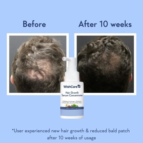 Wishcare Hair Growth Serum Concentrate With 3% Redensyl, 4% Anagain, Rice Water, Biotin - Image 8