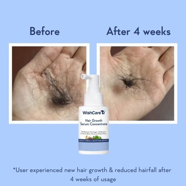 Wishcare Hair Growth Serum Concentrate With 3% Redensyl, 4% Anagain, Rice Water, Biotin - Image 7